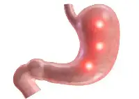 胃癌是“拖”出來的？4種徵兆或是胃在求救，發現後，儘快檢查
