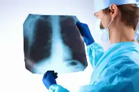 肩膀和背部出現一個訊號，肺癌可能已經來臨，建議拍一下CT