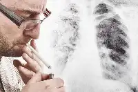 身體莫名有這6個症狀時，肺癌或已“入侵”體內，需多留意