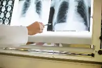 鐘南山院士多次強調要做這項肺部檢查！這幾類人尤其要注意